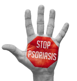 La prevención de la psoriasis