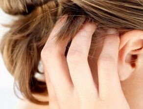 signos y síntomas de psoriasis en el cuero cabelludo